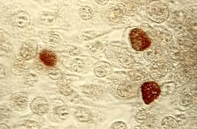 However, these classifications are based on laboratory behavior. Chlamydia Trachomatis Wikipedia