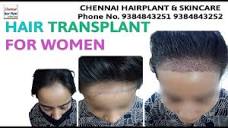 Female Hair Transplant Surgery