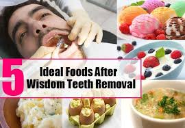 5 Ideal Foods After Wisdom Teeth Removal Wisdom Teeth Removal Food Wisdom Teeth Food After Wisdom Teeth Removal