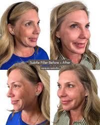 Best of Nashville ✨ Last night's Best of Nashville awards were such an  incredible reminder of all the amazing talent and services right here in  our community! We were thrilled to be