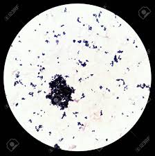 Whereas cocci can be pathogenic, symbiotic, or commensal that lives on the body of their host organism. Hemocultured Smear Of Gram Positive Cocci In Cluster Bacteria Under Stock Photo Picture And Royalty Free Image Image 92662991