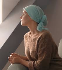 Radiation therapy affects hair only in the area where the radiation has been administered. Does Radiation Therapy Always Cause Hair Loss