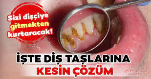 Bu konuda etkili olan birçok doğal yöntem vardır. Dis Taslari Nasil Gecer Iste Dis Tasindan Kurtulmanin Yollari Galeri Saglik