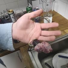 • store condoms in a cool, dry place. My Friends Broken Pinky Wrapped In A Condom Full Of Frozen Raspberries Because He Was Out Of Ice Album On Imgur