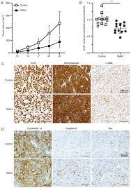Chromomycin A3 Suppresses Cholangiocarcinoma Growth By Induction Of S Phase Cell Cycle Arrest And Suppression Of Sp1 Related Anti Apoptotic Proteins