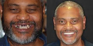 Transformative Dental Before & After