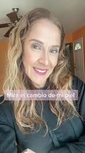 Prvega Antes Y Despues