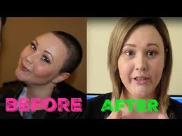 1 Year Hair Growth Update ♥