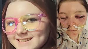 Stand With Lilly': Lemonade Stand Planned This Saturday For Mechanicsville  Teen Recovering From Crash