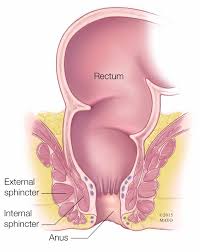 Image result for Fecal Incontinence