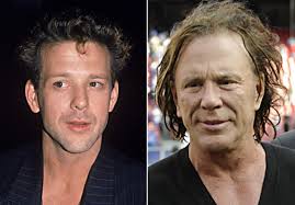 Mickey Rourke Was A 90s Hollywood Heartthrob But Years Of Self Destructive Celebrity Plastic Surgery Mickey Rourke Plastic Surgery Plastic Surgery Gone Wrong