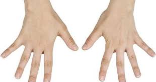 How To Relieve And Prevent Numbness In The Hand Numbness In Fingers Numbness In Hands Hand Exercises