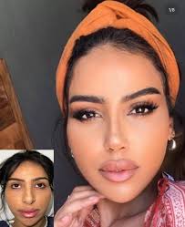 Cosmetic Surgery and Public Figures' Appearances