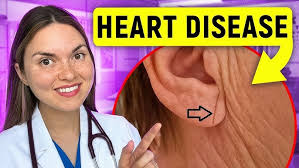 05 Salem Eid The role of immunotherapy in urothelial carcinoma