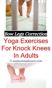 Permanent Remedy For Bow Legs Baby Bowed Legs Normal How To Correct Bow Legs In Babies Hindi Bow Legs Outfit K Bow Legged Correction Bow Legged Knock Knees