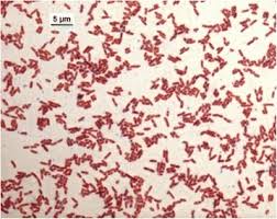 Image result for Pseudoeriosema borianii