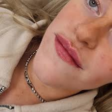 Faces Aesthetics And Beauty