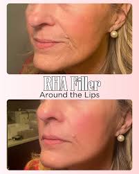 Jena Murphy NP-C (@the.cosmetic.np) · Instagram 照片和视频