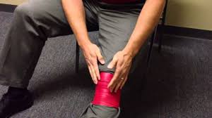 More on patellofemoral pain syndrome. Baker S Cyst Physiopedia