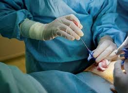 Image result for Bone Marrow Exam