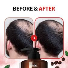 I used a bar of coal tar soap on patient the other day, he had it in his toilet bag, i was immediately wrights traditional is soothing, cleansing. Buy Kundal Anti Hair Loss Caffeine Scalp Care Deep Cleansing White Musk Shampoo X2 Bottles 500ml 16 9oz Online In Indonesia B087c1swy8