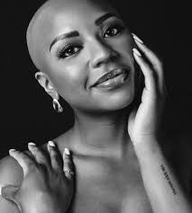 Dallas Cowboy Cheerleader Armani Latimer age 23 was diagnosed with Alopecia  at the age of 12 and for years she wore a wig when she goes