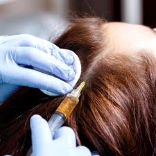 Pearl Hair Loss Therapy | Pearl Medical Aesthetics & Laser Center