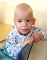 Pin By Carolynn Moore On Special Needs Fetal Alcohol Syndrome Fetal Alcohol Foetal Alcohol Syndrome