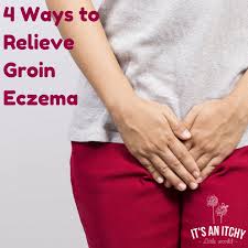 Groin pain can be divided into two types, namely indirect and direct pain. 4 Ways To Relieve Groin Eczema It S An Itchy Little World