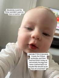 Allergic Reaction to Eggs