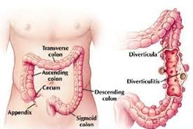 Kesakitan ini biasanya terjadi kepada wanita. Kenapa Perut Sebelah Kiri Terasa Sakit Mungkin Ini Penyebabnya Kaskus