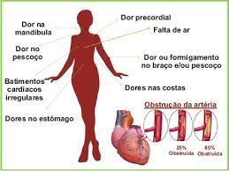 Esta é a via preferencial dado que reduz o. Artigos Infarto Agudo Do Miocardio Iam