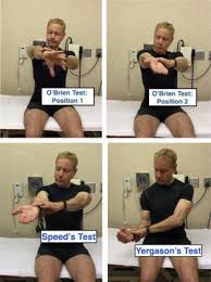 Image result for Yergason Test