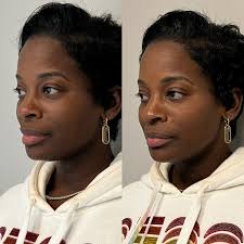 Maryellen Bishop, PA-C, Atlanta Injector, Filler & Botox Expert