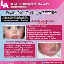 Gatal & eczema merupakan kulit sensitif. Eczema Buatkan Anak Comel Klinik Perubatan Lita Alis Facebook