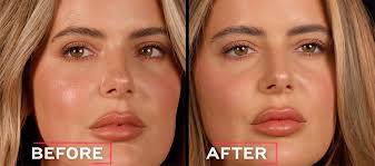 Christie Brinkley Reveals Her Cosmetic Procedures