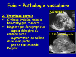 Docteur Baudin Guillaume Ppt Video Online Telecharger