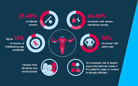 Common signs and symptoms of endometriosis include: Endometriosis Pharmaceuticals