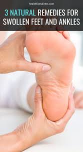3 Natural Remedies For Swollen Feet And Ankles Swollen Feet Foot Remedies Swollen Feet Remedy