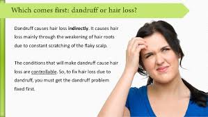 Dandruff does not cause direct hair loss, but can play a huge role in accelerating it. Does Dandruff Cause Hair Loss
