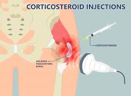 Image result for Hip Injection