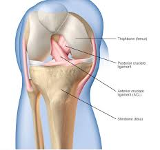 What does acl surgery entail? Acl Surgery Which Graft Is Best Andrew Dold Md Orthopedic Surgeon And Sports Medicine Specialist