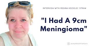 Regina had a 9cm Meningioma -