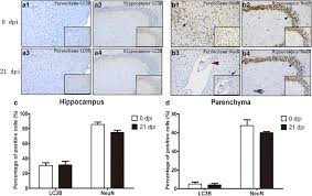 Founded in 1971 in portland, oregon, the dpi group has expanded to eight locations in six states. Apoptosis And Necroptosis Of Mouse Hippocampal And Parenchymal Astrocytes Microglia And Neurons Caused By Angiostrongylus Cantonensis Infection Parasites Vectors Full Text