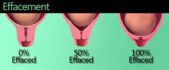 Effacement And Dilation Explained Pregnancy Families Com