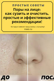 как быстро сузить поры на лице в домашних условиях Pory Na Lice Kak Suzit I Ochistit Prostye I Effektivnye Rekomendacii Sagging Skin Face Hairstyles For School Beauty Recipe