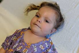 4-year-old Tennessee girl dies from rare genetic disorder