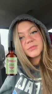 Just use rosemary oil babes 🥴 #miellehairoil #rosemaryoil