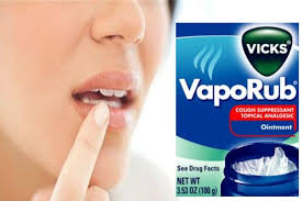 Pin By Bethany Rose On Good To Know Cold Sore Cold Sore Treatment Vicks Vaporub
