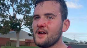 Colonel Light Gardens player Bryce Smith wins match with his face